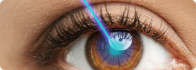 Cirurgia Refrativa em Rio Branco